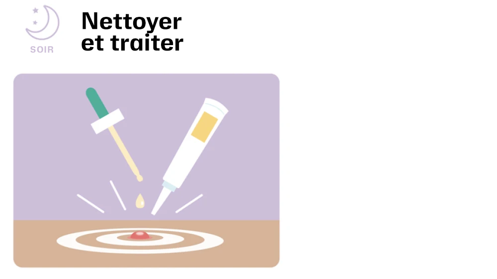 Soir : Nettoyer et traiter