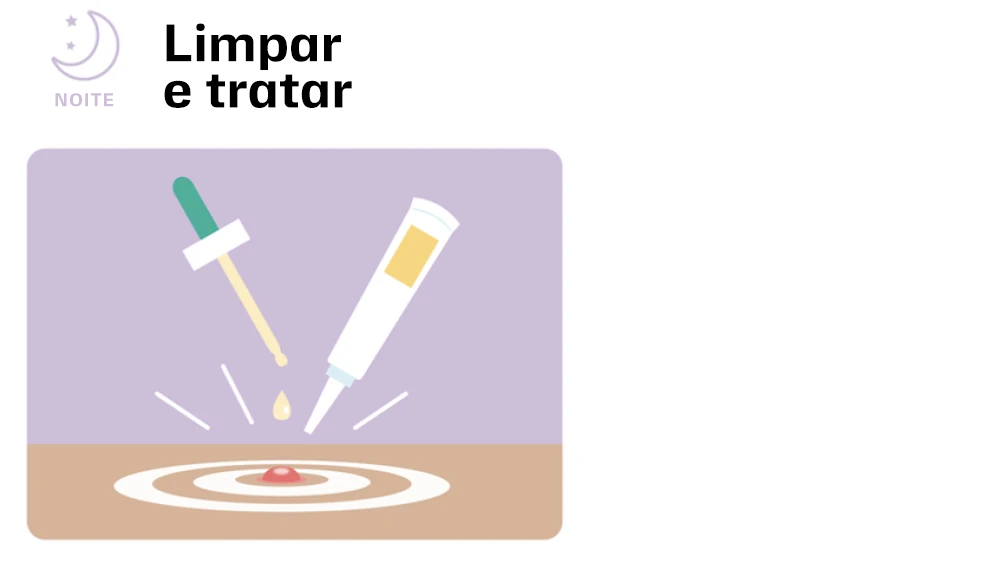 Noite: Limpar e tratar